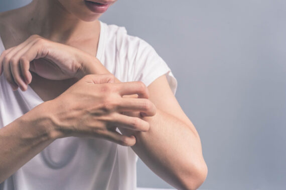 Essential Questions to Ask Your Dermatologist About Eczema