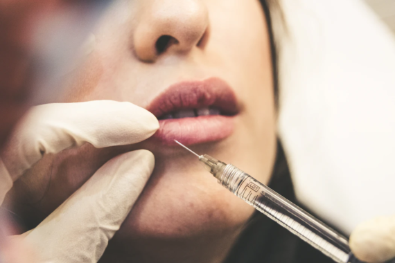 Can You Be Too Young to Try Botox?