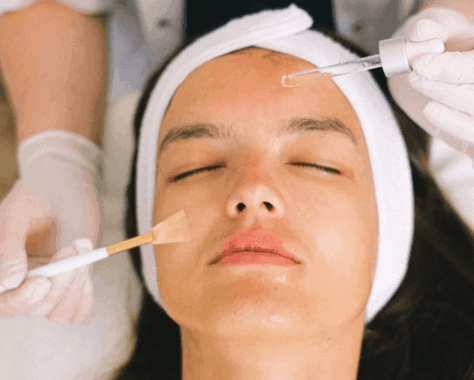 Don’t like needles? Don’t worry! Treat your aging skin with a chemical peel!