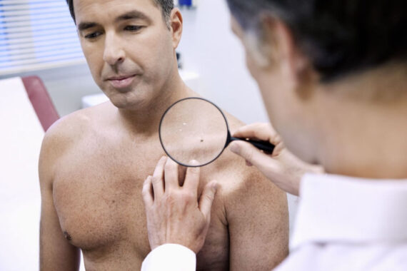 Can Blu-U Light Help With Skin Cancer Treatment?