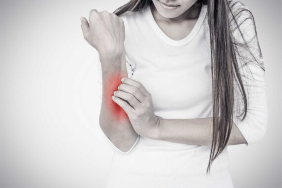 Eczema on Arms and Hands: A Guide to Mitigating Eczema