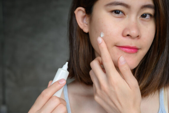 How Can One Get Rid of Acne as Quickly as Possible? A Guide