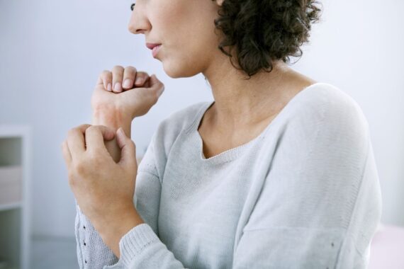 Skin Care: How to Get Rid of Hives on Your Face