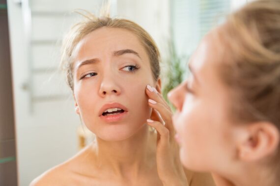 What Does the Diagnosis and Treatment of Acne Mean?