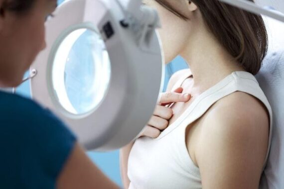 How to Inspect Moles on Your Body