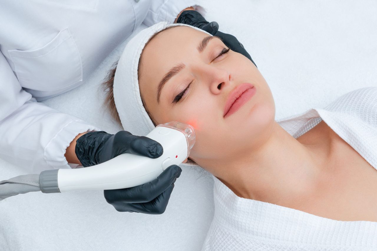 ExcelV+ Laser Treatment